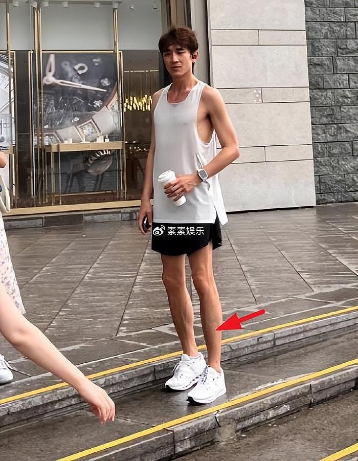 林更新在香港冒雨跑步，又高又瘦很自律，腿上还有一大块淤青 - 3