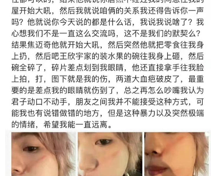 歌手尹毓恪深夜发长文控诉，自曝遭焦迈奇殴打，后者紧急发文道歉 - 2