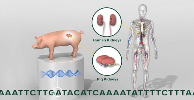 猪器官移植再传捷报!全球首例猪肾脏成功移植入人体 - 2