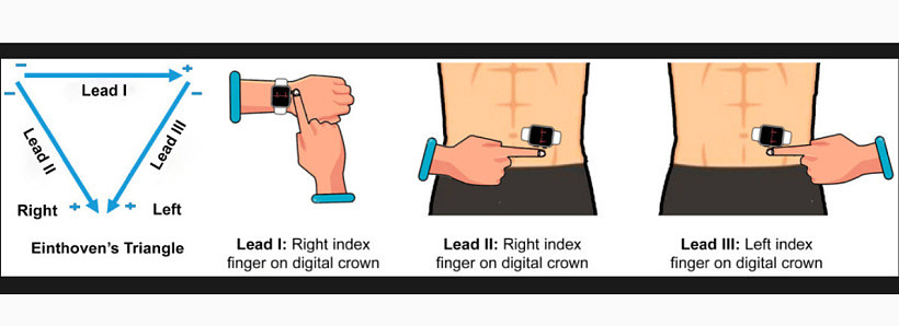 研究表明苹果Apple Watch具有潜在检测心脏病发作的能力 - 2