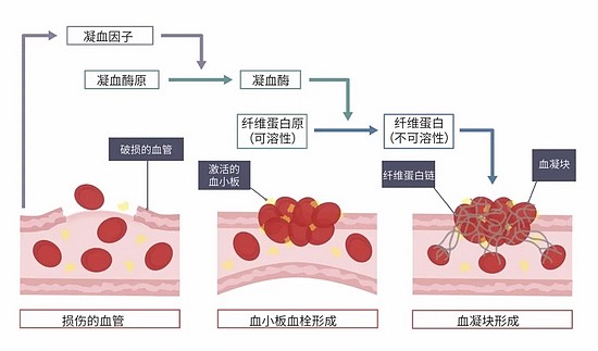 凝血因子级联反应形成纤维蛋白网 | http://igcse-biology-2017.blogspot.com/2017/06/264b-understand-how-platelets-are.html，作者汉化