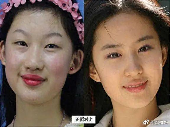 19岁少女执意整成刘亦菲，连名字也高仿，8年后却过上另一种人生 - 1