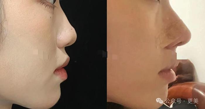 韩素希割双眼皮前，就是典型的韩式肿眼泡啊… - 48