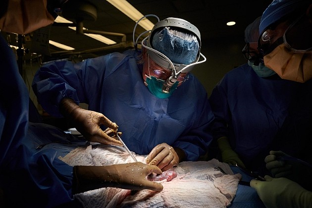 罗伯特·蒙哥马利博士在纽约大学朗格尼医学中心进行了第一例基因工程非人类肾脏异种移植手术。