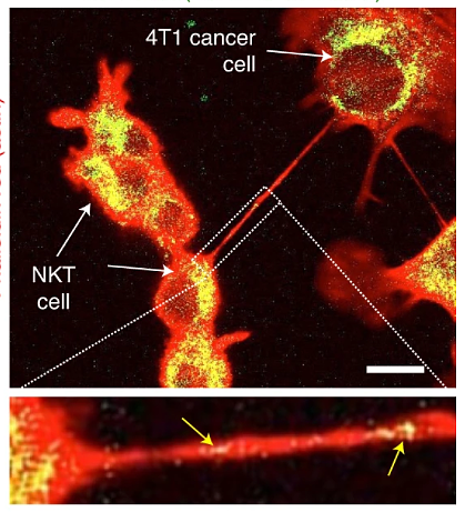 首次发现：癌细胞竟能“伸出大手”，掏走免疫细胞的线粒体！ - 4