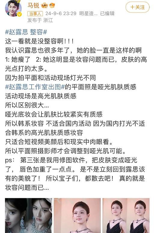 25岁赵露思被质疑整容，垫鼻子做“嘟嘟唇”像张元英，工作室回应 - 6