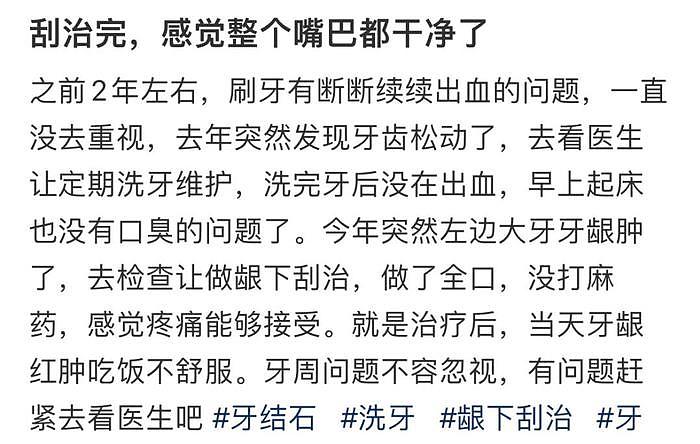 从C位癌到踩队友，张元英的mean感原来早有源头… - 41