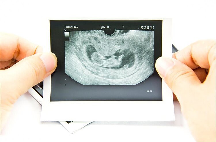 胚胎停育都是有前兆的，如果有这些症状要及时就医，保胎还来得及 - 2