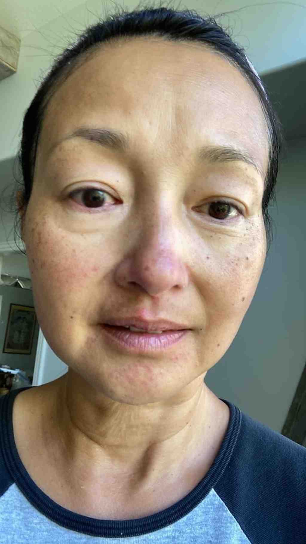 52岁港姐李绮虹素颜近照曝光，皱纹明显满脸红疹，笑称更年期问题 - 1