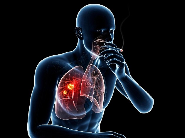 为什么有些老烟民不患肺癌？体内存在某种强大抗变异机制 - 1