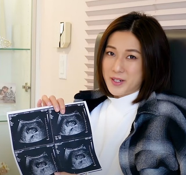 钟嘉欣自曝已经怀孕10周 目前极度情绪化 将会是最后一胎 - 3