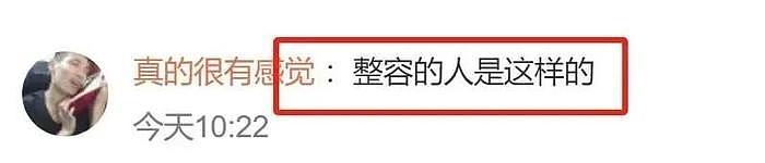 金晨近照又变脸！鼻子变宽嘴变大成“姚晨”？网友：亲妈都认不出 - 14