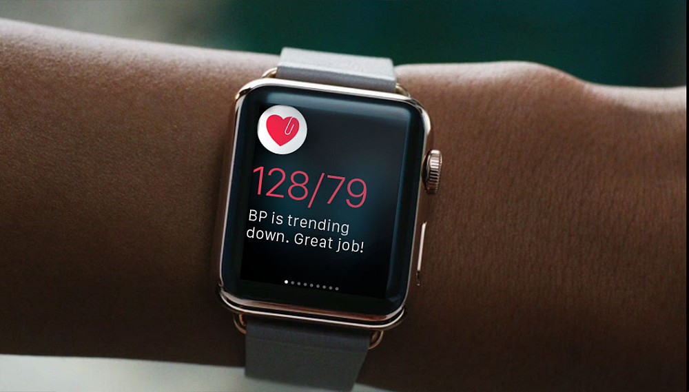 苹果启动心率数据研究项目，通过 Apple Watch 监测不规律心跳 - 1