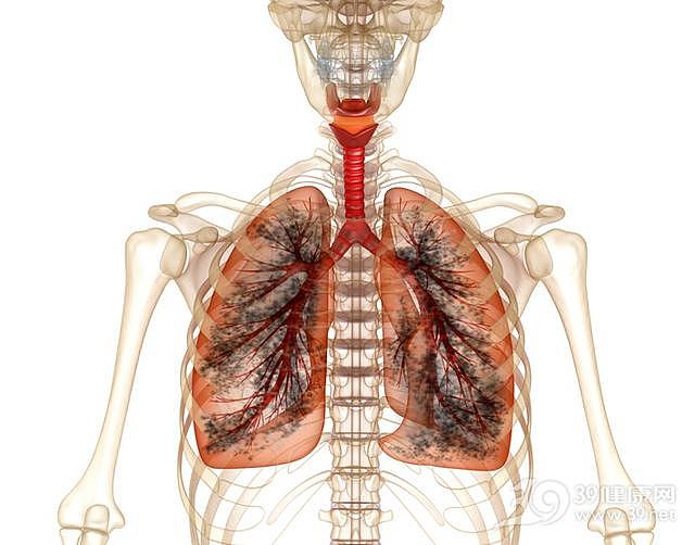 肿瘤专家：越来越多人得肺癌，这4点才是伤肺源头！
