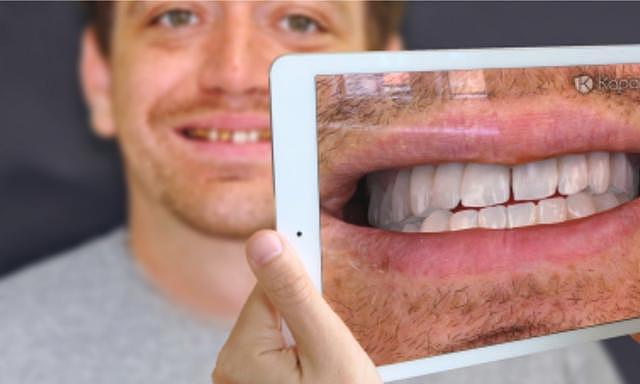 牙痛不敢看牙医？瑞士创企Kapanu推出AR诊疗工具，补牙整牙效果自己选