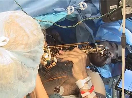 美音乐教师做开颅手术 一边手术一边演奏萨克斯 - 1