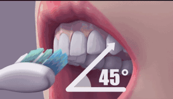 “认真”刷牙，会把牙龈刷没了！很多人都犯这错，细思极恐 - 3