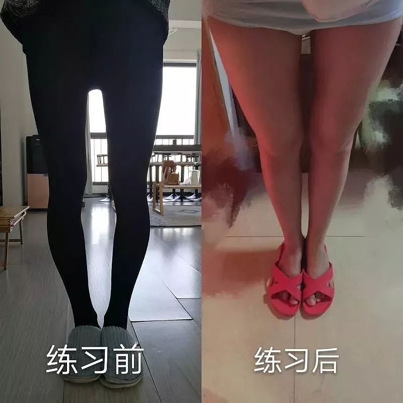 韩国“第一腿精”爆红网络：被小粗腿毁掉的女人，该如何自救？ - 24