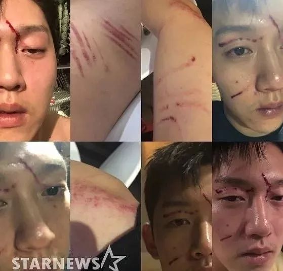 韩国女星被男友以性爱视频威胁：从阿娇到具荷拉，为何受伤害的总是女性？ - 2
