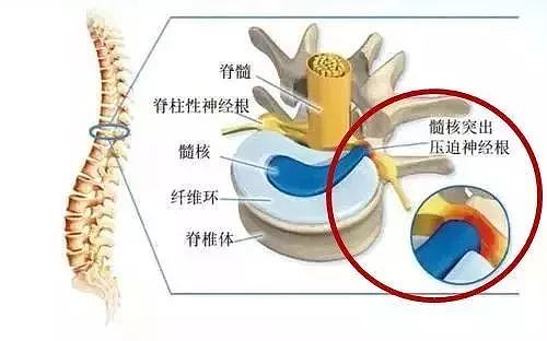 中老人年人腿抽筋，别盲目补钙！这些才是真正原因…… - 2