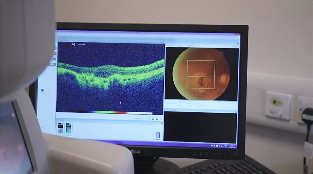 DeepMind 第一个有望商业化的产品：用 AI 诊断眼部疾病 - 5