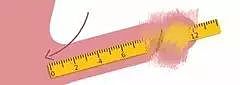 如何准确测量丁丁大小和粗度~ - 1