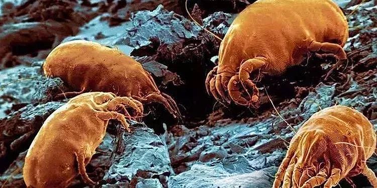 你脸上每天有1万只螨虫在爬！用它洗脸洗澡，痘痘、黑头、瘙痒都好了 - 2