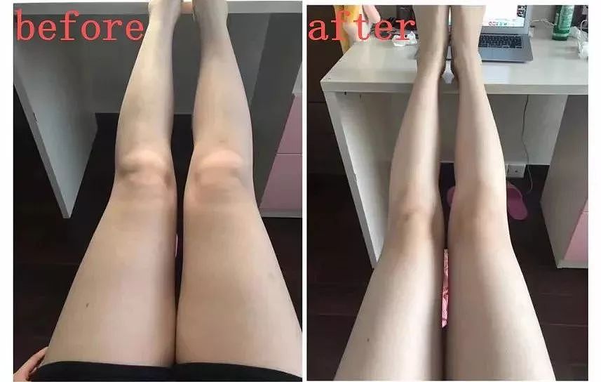 韩国“第一腿精”爆红网络：被小粗腿毁掉的女人，该如何自救？ - 21