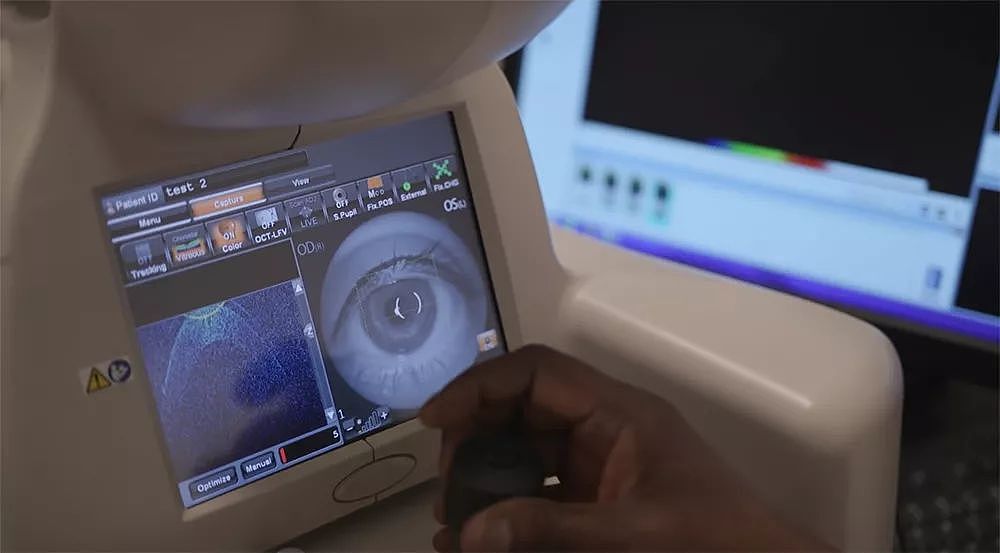 DeepMind 第一个有望商业化的产品：用 AI 诊断眼部疾病 - 4