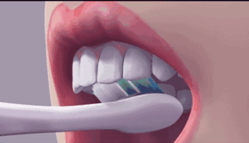 “认真”刷牙，会把牙龈刷没了！很多人都犯这错，细思极恐 - 6