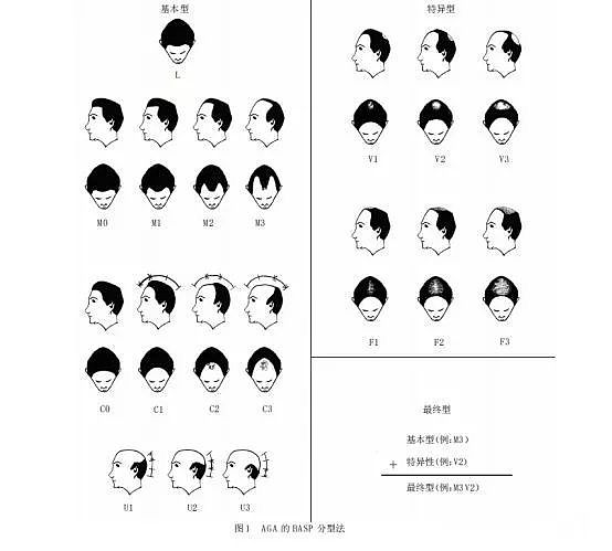 OMG | 男朋友在土耳其植发后的第三天，我想到了分手 - 8