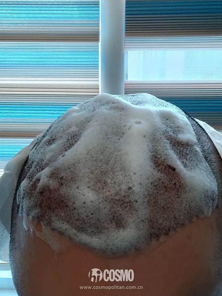 OMG | 男朋友在土耳其植发后的第三天，我想到了分手 - 26