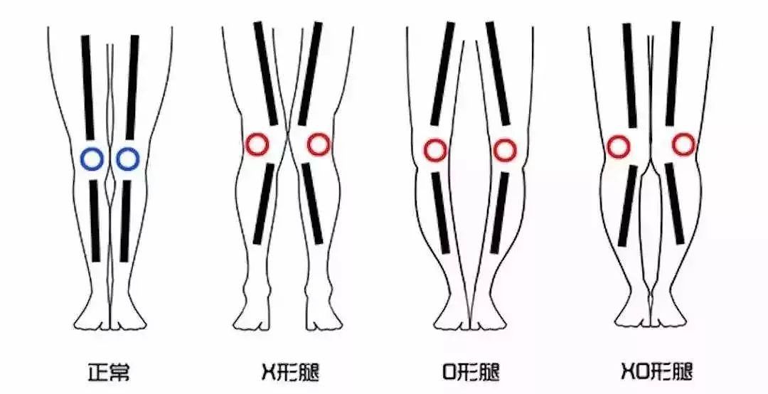 韩国“第一腿精”爆红网络：被小粗腿毁掉的女人，该如何自救？ - 7