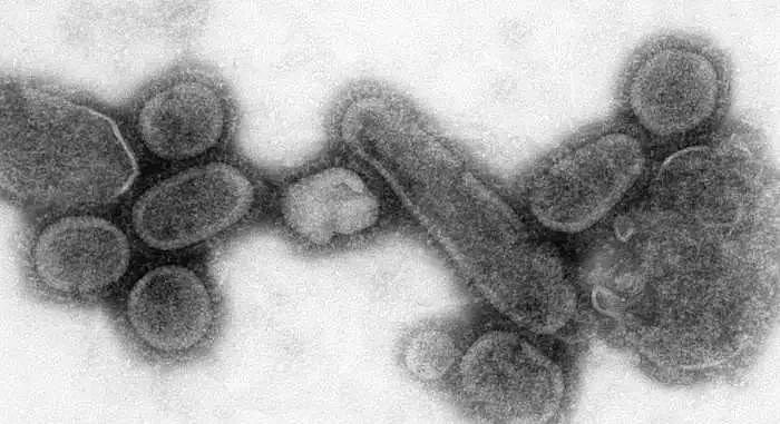 寻找流感病原：百年前曾在十个月内杀死全球近1亿人 - 6