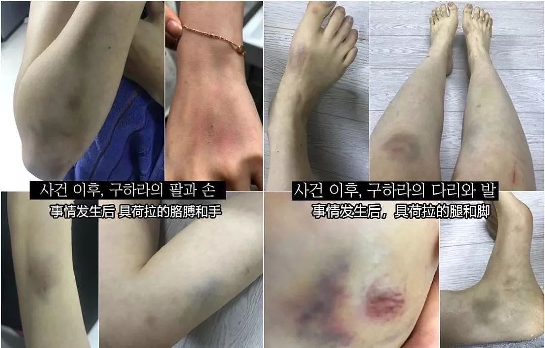 韩国女星被男友以性爱视频威胁：从阿娇到具荷拉，为何受伤害的总是女性？ - 3