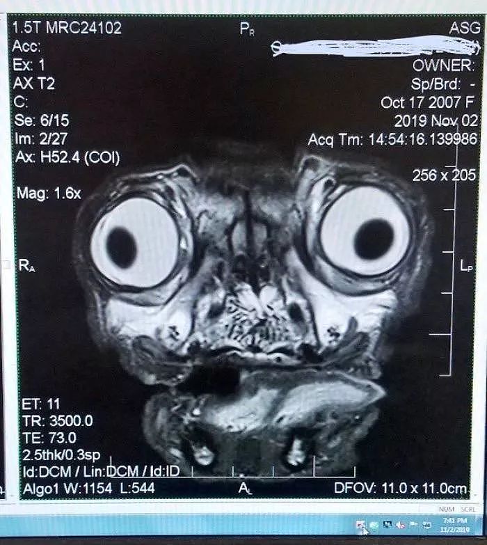网友带巴哥做MRI检查，看到结果时惊呆了：这货是外星狗？ - 2