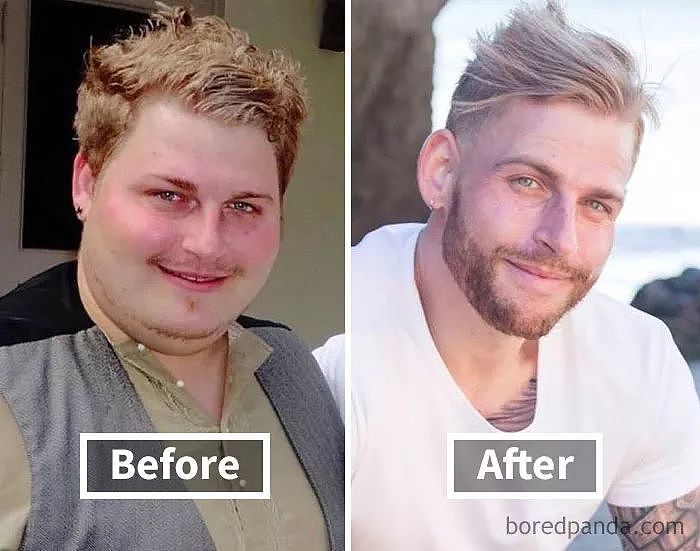 减掉50斤后，脸型会发生哪些变化？ - 3