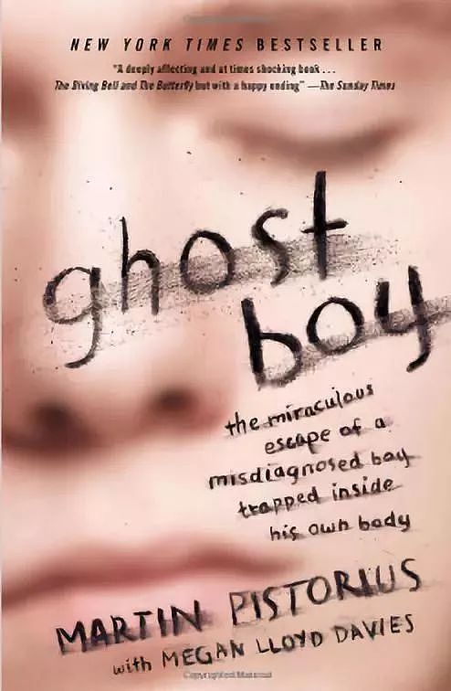 幽灵男孩“死亡”13年后复活，他才是世上最孤独的人 - 4