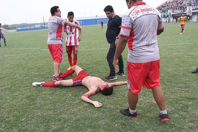 进球后庆祝激怒对手，巴西一球员被群殴当场晕厥